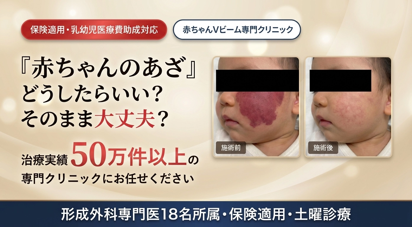 赤ちゃんのあざ どうしたらいい?そのまま大丈夫? 治療実績50万件以上の専門クリニックにお任せください 保険適用・乳幼児医療費助成対応 形成外科専門医18名所属・保険適用・土曜診療