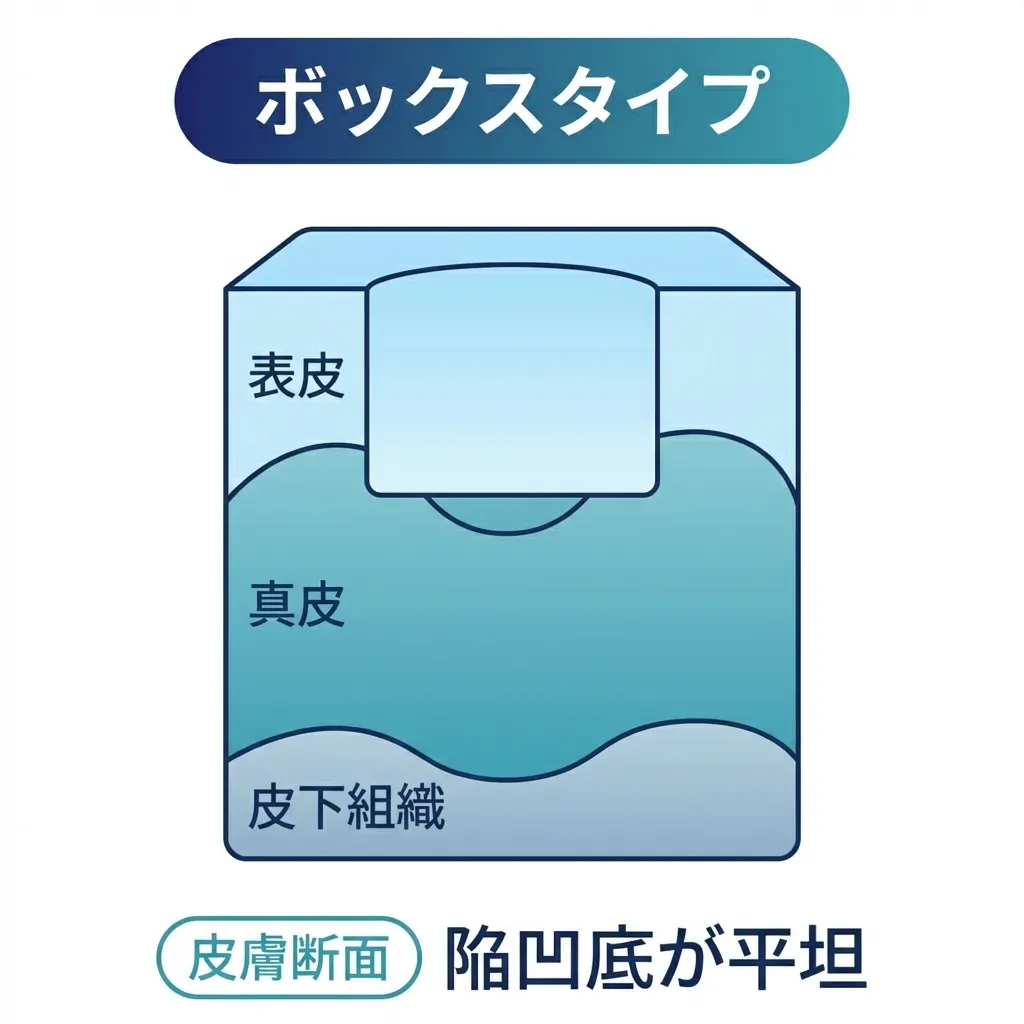 ããã¯ã¹åã¯ã¬ãŒã¿ãŒ